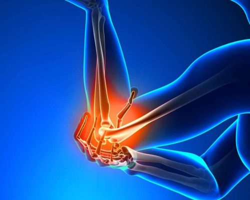 elbow pain treatment