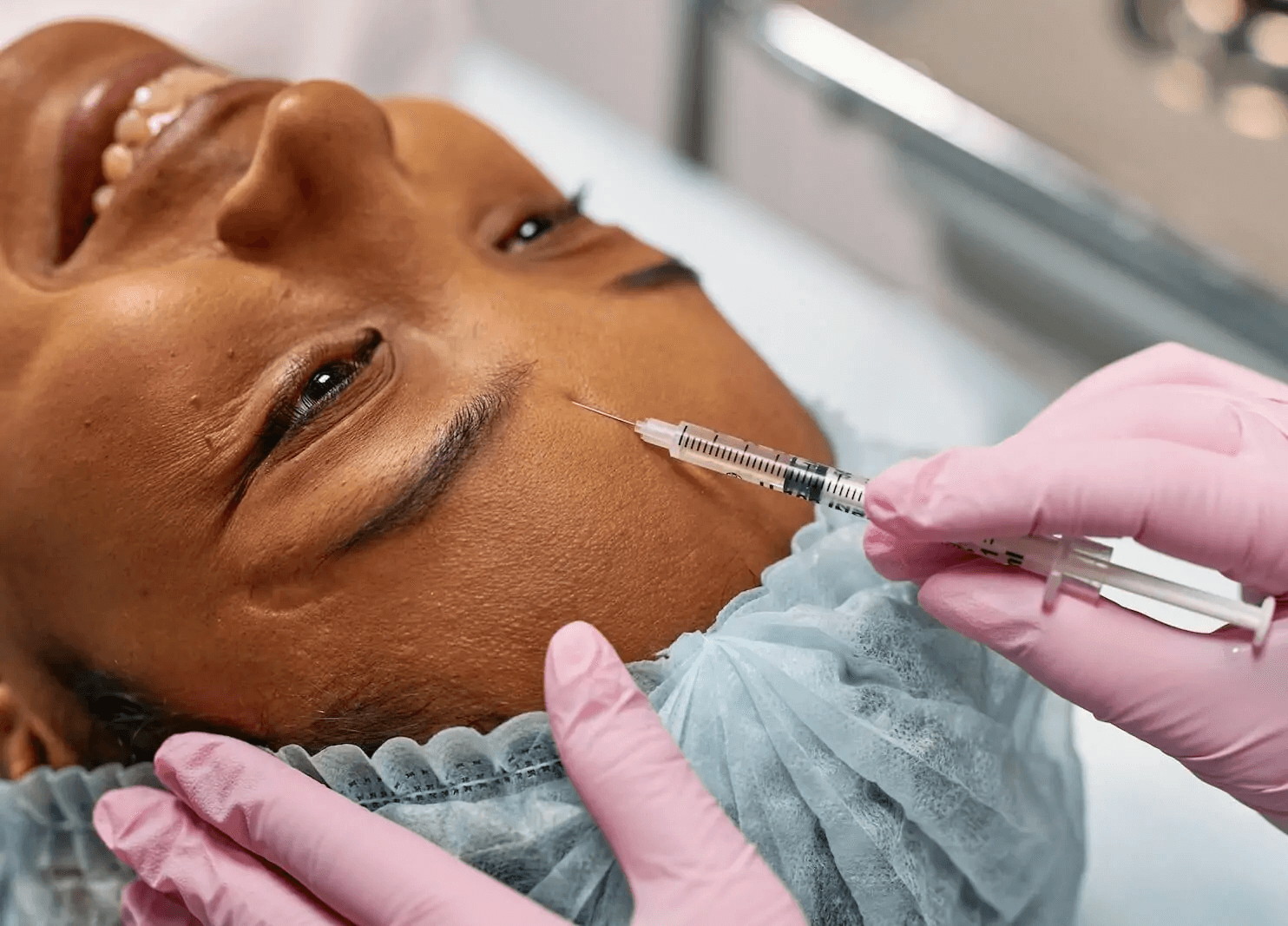 botox for wrinkle prevention